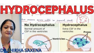 Hydrocephalus high CSF pressure communicating and noncommunicating Hydrocephalus [upl. by Elleret]