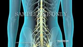 Epidural Spinal Injection [upl. by Nicky]