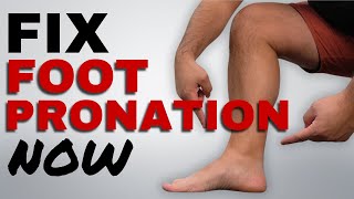 Correct Foot Pronation with these 5 Essential Running Exercises [upl. by Cirone185]