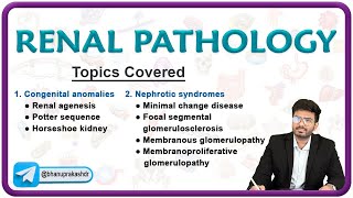 🌟 Exploring Renal Pathology Congenital Anomalies amp Nephrotic Syndromes 🌊 [upl. by Katrine]