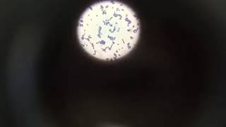 Microorganimos Enterococcus faecium [upl. by Anertak]