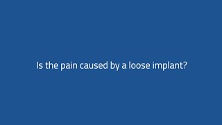 Sectra Implant Movement Analysis – introduction [upl. by Landis]