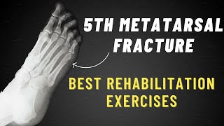 5th Metatarsal Fracture Exercises  6 Week Program [upl. by Krys3]