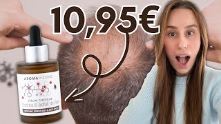 CALVITIE CHUTE DE CHEVEUX  JE TESTE LE SÉRUM CHEVEUX AROMAZONE À 1095€ [upl. by Kappenne]