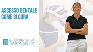 Ascesso dentale come si cura [upl. by Legge]