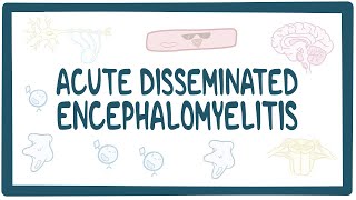 Acute disseminated encephalomyelitis ADEM [upl. by Abdulla]