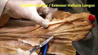 FOOT DORSUM Tendons Muscles Neurovascular and Clinical Correlations – Sanjoy Sanyal [upl. by Aihsined]