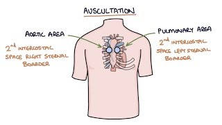 Heart Murmurs and Heart Sounds Visual Explanation for Students [upl. by Esinart]