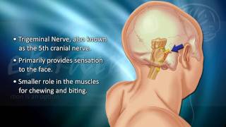 Understanding Trigeminal Neuralgia  eBrainMDcom [upl. by Wiskind]