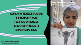 GRAVIDEZ nas Trompas gravidez ectópica  Entenda [upl. by Anola639]