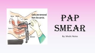 OampG Pap smear  revision for medical students [upl. by Lrac]