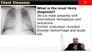 Chest Quick note internalmedicine cme usmle محاضراتباطنة ecg clinical medicine [upl. by Joye]