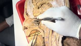 Lateral wall of nose dissection and sagittal section of head and neck [upl. by Els949]