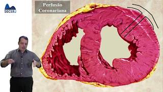 Curso Básico de ECG  Aula 06 Distúrbios da Perfusão Miocárdica [upl. by Franky]