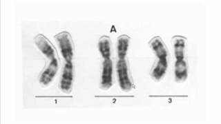 diferencias entre cromosomas [upl. by Haidedej]