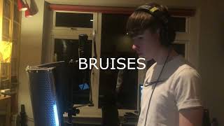 Bruises  Lewis Capaldi Cathal Mulvey Cover [upl. by Atekahs656]