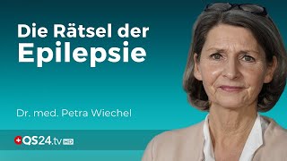 Epilepsie und Behandlung Wenn die Therapie an ihre Grenzen stößt  Dr med Petra Wiechel  QS24 [upl. by Slade]