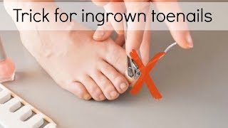 How to Fix Ingrown Toenails Easily [upl. by Leonsis]