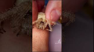 La morsure d’Araneus cavaticus une araignée sans danger pour l’humain spider wildlife [upl. by Nylloc575]