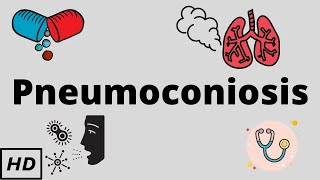 Pneumoconiosis Causes Signs and Symptoms Diagnosis and Treatment [upl. by Melvina859]