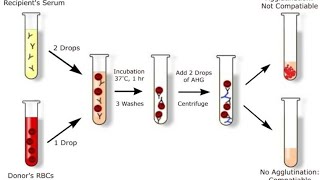 cross matching blood procedure [upl. by Emalee]