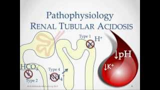 Renal Tubular Acidosis  USMLE STep 2 Review [upl. by Amikay959]