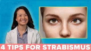 4 Great Ways to Treat Your Strabismus [upl. by Enylodnewg]