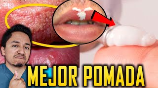 La Mejor CREMA para Eliminar los Granos de Fordyce en los Labios de la Boca [upl. by Beckerman]