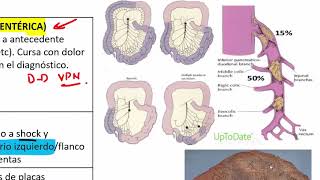 3 ABDOMEN AGUDO VASCULAR [upl. by Eneg]