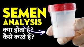 Semen Analysis Test Procedure amp Report in Hindi  Semen Analysis Kaise Hota Hai [upl. by Aseiram]