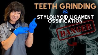 Teeth Grinding amp Stylohyoid Calcification  Dr Agatha Bis [upl. by Canute]