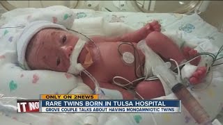 Very rare monoamniotic quotMoMoquot twins born to Tulsa couple [upl. by Belle815]