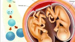 Everything You Need To Know About Fraternal and Identical Twins  Dr Sarah Finch [upl. by Hieronymus]