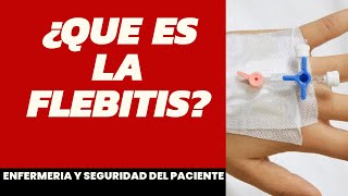 ¿Que es la flebitis enfermería [upl. by Rachaba351]