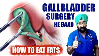 Rx GallStones 3 Hindi ऑपरेशन के बाद डाइट और दस्त  AFTER GALLBLADDER SURGERY  by DrEducation [upl. by Nyliuqcaj280]