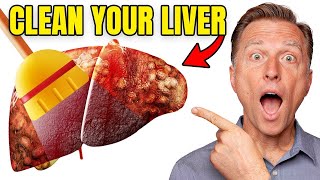 Top BEST Foods to Clean Out Your Liver [upl. by Tita79]