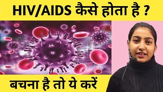 HIVAIDS कैसे होता हैबचना है तो ये करेंHIVAIDS causes symptoms diagnosis and treatment [upl. by Vershen669]