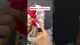 Mystery tooth ache It could be a muscle tmj [upl. by Dnalevelc]