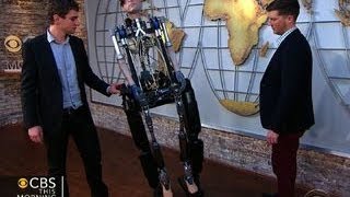 Watch The worlds first fullyfunctional bionic man [upl. by Tullus]