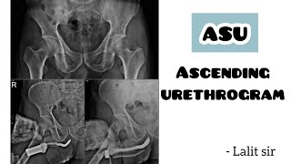 Ascending urethrogram  ASU  scparamedicalinstitute8221 [upl. by Tallia]