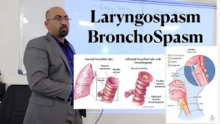 lec LaryngoSpasm amp Bronchospasm [upl. by Kcirtemed74]