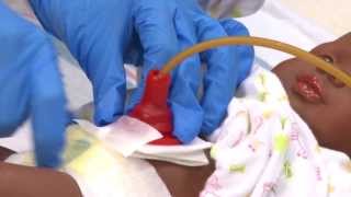 Caring for My Child with a Gastrostomy Tube  St Louis Childrens Hospital [upl. by Dorahs846]