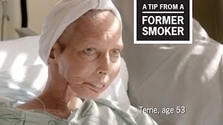 CDC Tips From Former Smokers  Terrie H Surgeon General Ad [upl. by Rahsab]