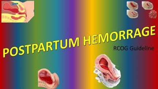 Postpartum Haemorrhage PPH RCOG Guideline [upl. by Wack]