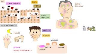 Sarna  Sarcoptes Scabiei [upl. by Heater]