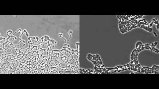 Pseudomonas aeruginosa biofilm expansion via twitching motility [upl. by Euqinay]