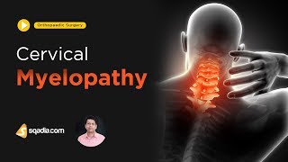 Cervical Myelopathy  Orthopaedic Surgery  Medical Student Lectures  VLearning [upl. by Angelita]