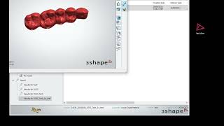 Convert dcm files into stl with 3shape [upl. by Htidirrem]