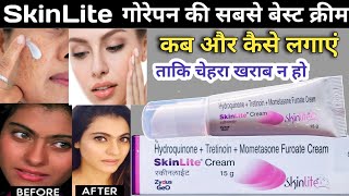 SkinLite Cream Review in Hindi  गोरेपन कि क्रीम  fairness cream  Skin lite Cream Use kaise karen [upl. by Nahoj]