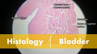 Histology of the Bladder [upl. by Ailugram]